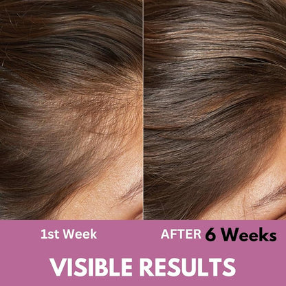 Havelyn Hair Food 7 Oils In One – Herbal Hair Growth Oil (200ml) | Anti Hair Fall, Dandruff Control & Scalp Treatment with 30+ Herbs